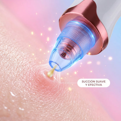 Succionador Poros y Puntos Negros